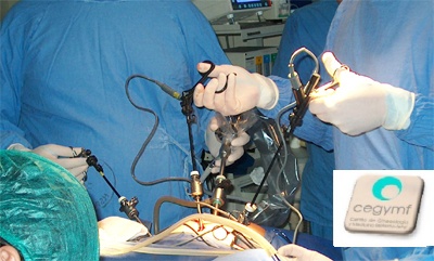 laparoscopia Cegymf